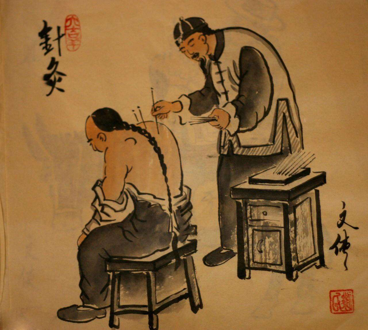 中医知识——颈椎病针灸能治好吗 这些方法能缓解颈椎病